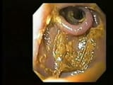 TimedWatcher