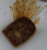 1200px-Traveler&#039;s_diarrhea