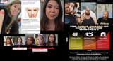 NPCS-INJECTED