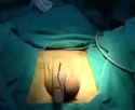 tranny surgery_thumb.jpg