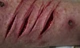 cuts 1