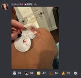 popping