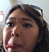 downsyndromepatient