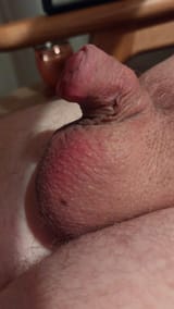 1000048992