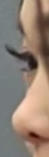 protrudingeyeuggoee