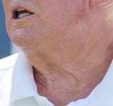 turkey neck