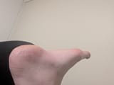 1000000816