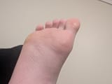 1000000817