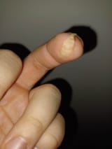 one of the best scabs