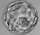 Blastocyst-Transfer
