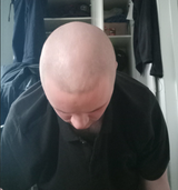 Bald head