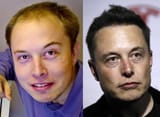 Elon_musk_hairline