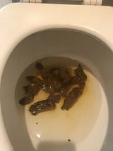 Fecal_poop_2