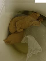 FECES
