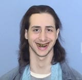 teefs-shane