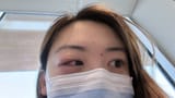 eyefan