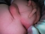 1000015451