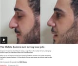 nose job
