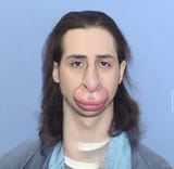 lipsnose-shane
