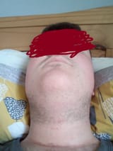 My beard 2 (face obscured)