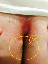 disgusting unclean ass crack