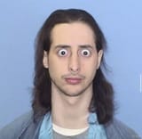 thyroid-shane