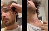 miz-chokes-twinks