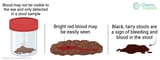 blood-in-stool