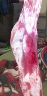 543