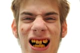 yellow-teeth-11658263