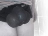 Implants