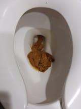 turds