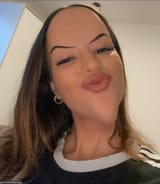 niceforehead