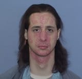 psoriaticshane