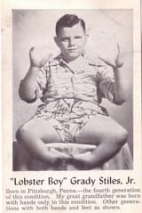 lobsterboy