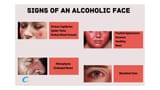 Signs-of-an-Alcoholic-Face-1024x576