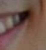 smileforme