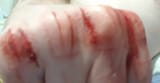 tase blood