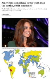 british teeth