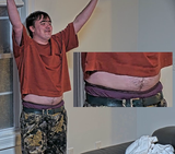 tummy