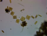 Diatoms and Cyanobacteria