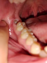tooth
