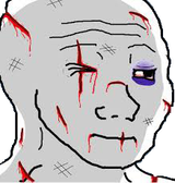 injured_wojak