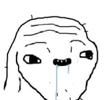 BrainletForhead