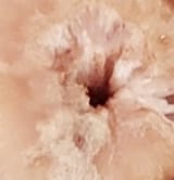 smell