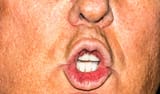 mouth