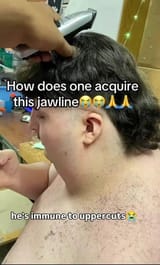 1000035023