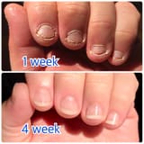 bitten fingers