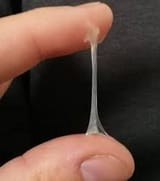 vaginal-discharge-1
