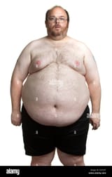 man-in-his-late-40s-weighing-in-around-450-pounds-morbid-obesity-D3YC0T